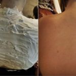 Izgorjela je na suncu, a 1 trik ju je spasio za pola sata: RIJEČ JE O PROIZVODU KOJI SVI IMAMO U KUĆI