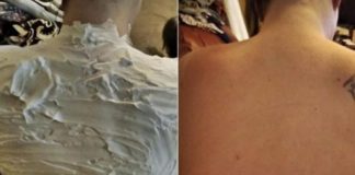 Izgorjela je na suncu, a 1 trik ju je spasio za pola sata: RIJEČ JE O PROIZVODU KOJI SVI IMAMO U KUĆI