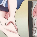 Evo na šta ukazuje bol u listovima i butinama: GRČEVI U NOGAMA SU OPASAN SIMPTOM!