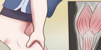 Evo na šta ukazuje bol u listovima i butinama: GRČEVI U NOGAMA SU OPASAN SIMPTOM!