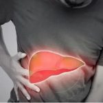 Prvi simptom MASNE JETRE vidi se na LICU obolelog – Znojenje i loš dah se najlakše prepoznaju, ali ove SIGNALE tela mnogi zanemare