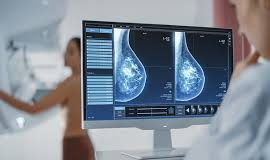 Prim. dr. Amela Karabeg o karcinomu dojke: Rano otkrivanje je najvažnije za izlječenje