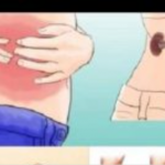 KAD SA BUBREZIMA NIJE SVE U REDU, TIJELO ŠALJE OVE SIGNALE: 6 Simptoma koje ne smijete ignorisati!