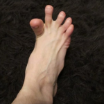 DA LI VAM SE GRČE PRSTI NA STOPALIMA? Evo Na Šta Vas To Upozorava, Može Biti Znak Većih Problema