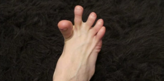 DA LI VAM SE GRČE PRSTI NA STOPALIMA? Evo Na Šta Vas To Upozorava, Može Biti Znak Većih Problema