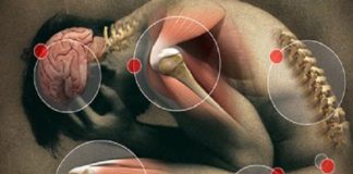 OBLOG KOJI IZVLAČI SAV BOL IZ TIJELA: Provjeren lijek koji ublazava reumu, išijas, giht i artritis…