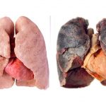 ČIME OČISTITI PLUĆA PUŠAČA? POGLEDAJTE 10 LAGANIH NACINA