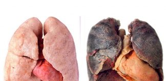 ČIME OČISTITI PLUĆA PUŠAČA? POGLEDAJTE 10 LAGANIH NACINA