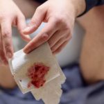 Kako Najbrže Prepoznati Rak Debelog Crijeva: Ključni Simptomi Koje Ne Smijete Zanemariti