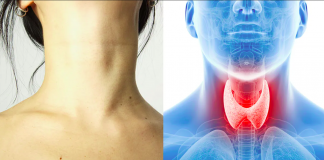 Svaka Kašika Ove Smjese Zlata Vrijedi: Vraća Funkciju Štitne Žlijezde u Normalu