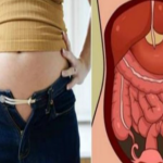 Mislite da ste debeli,a možda se radi o ovome:Zbog čega je stomak velik?