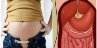 Mislite da ste debeli,a možda se radi o ovome:Zbog čega je stomak velik?