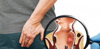 Prijeki lijek za bakterije u želucu, hemoroide i crijevna oboljenja