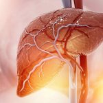 Simptomi bolesne jetre: Kako se manifestuju na koži i nogama