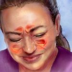 Kako očistiti sinuse od gnoja i sluzi: Disat ćete punim plućima za 10 dana!