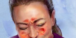 Kako očistiti sinuse od gnoja i sluzi: Disat ćete punim plućima za 10 dana!