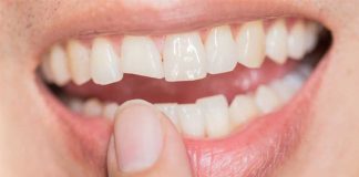 Svaki Zub Je Povezan Sa Nekim Organom u Tijelu: Kako Bol u Zubu Ukazuje na Zdravstvene Probleme