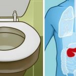 Kako prepoznati simptome raka gušterače?