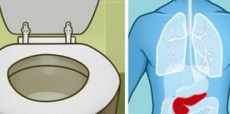 Kako prepoznati simptome raka gušterače?