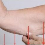 EVO ZAŠTO IMATE NEOBIČNO OBJEŠENU KOŽU- Većina ljudi nema pojma o ovom problemu. Jedino efikasno rješenje je ovaj domaći trik