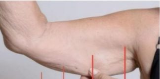 EVO ZAŠTO IMATE NEOBIČNO OBJEŠENU KOŽU- Većina ljudi nema pojma o ovom problemu. Jedino efikasno rješenje je ovaj domaći trik