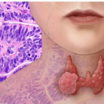 AKO IMATE PROBLEM SA ŠTITNOM ŽLIJEZDOM, OVE 2 NAMIRNICE IZBACITE: Štitna žlijezda ih nikako ne voli