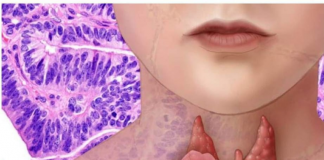 AKO IMATE PROBLEM SA ŠTITNOM ŽLIJEZDOM, OVE 2 NAMIRNICE IZBACITE: Štitna žlijezda ih nikako ne voli