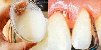 SKINITE KAMENAC I UNIŠTITE BAKTERIJE U USTIMA SA SAMO JEDNIM SASTOJKOM (RECEPT)