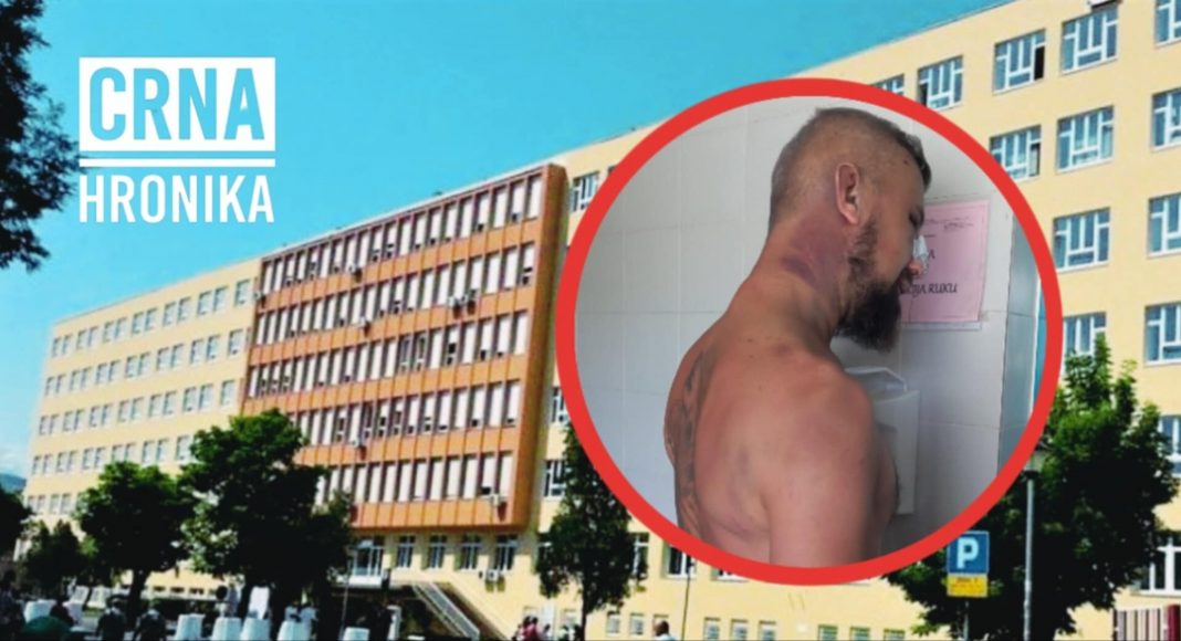 Alen Čeliković tvrdi da je mučen i pretučen – završio na UKC-u Tuzla s teškim povredama - featured image