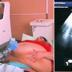 Trudna žena ima 226 kilograma i došla je na ultrazvuk, a onda je medicinska sestra podigla njen stomak i pogledala bolje: H0R0R KAKAV DO SAD NISTE VIDJELI… (VIDEO) Trudna žena ima 226 kilograma i došla je na ultrazvuk, a onda je medicinska sestra podigla njen stomak i pogledala bolje… (VIDEO) - featured image