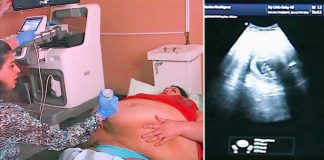 Trudna žena ima 226 kilograma i došla je na ultrazvuk, a onda je medicinska sestra podigla njen stomak i pogledala bolje: H0R0R KAKAV DO SAD NISTE VIDJELI… (VIDEO) Trudna žena ima 226 kilograma i došla je na ultrazvuk, a onda je medicinska sestra podigla njen stomak i pogledala bolje… (VIDEO) - featured image