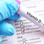 BOLE VAS KOLJENA, NEKONTROLISANO SE GOJITE…: DOKTORKA otkrila ŠEST ZNAKOVA koji ukazuju da vam fali vitamin D