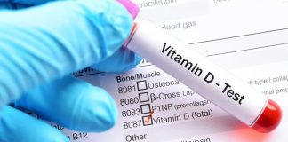 BOLE VAS KOLJENA, NEKONTROLISANO SE GOJITE…: DOKTORKA otkrila ŠEST ZNAKOVA koji ukazuju da vam fali vitamin D