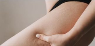 ZBOG JEDNE NAMIRNICE RASTE STOMAK: Evo zašto žene muku muče sa KILAŽOM I CELULITOM, Dr. Filgud savjetuje da izbacite ovu namirnicu iz jelovnika