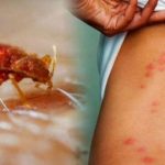 STJENICE U DOMU: PREPOZNAJTE IH NA VRIJEME I RIJEŠITE SE NAJBRŽE MOGUĆE STJENICE U DOMU: PREPOZNAJTE IH NA VRIJEME I RIJEŠITE SE NAJBRŽE MOGUĆE - featured image