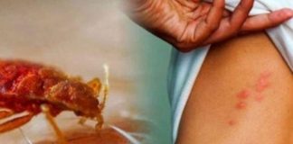 STJENICE U DOMU: PREPOZNAJTE IH NA VRIJEME I RIJEŠITE SE NAJBRŽE MOGUĆE STJENICE U DOMU: PREPOZNAJTE IH NA VRIJEME I RIJEŠITE SE NAJBRŽE MOGUĆE - featured image