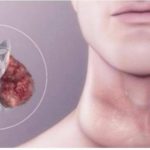 Umor, debljanje i tuga. Ukoliko osjetite PROMJENE u sebi zajedno sa NOVOTKRIVENIM simptomima problema sa štitnom žlijezdom, NEMOJTE IH IGNORISIRATI! Umor, debljanje i tuga. Ukoliko osjetite PROMJENE u sebi zajedno sa NOVOTKRIVENIM simptomima problema sa štitnom žlijezdom, NEMOJTE IH IGNORISIRATI! - featured image